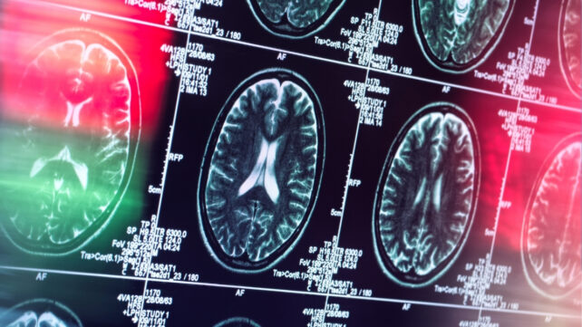 brain scans