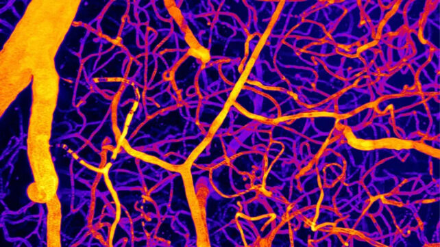 Brain image
