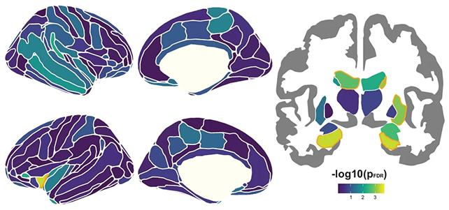 Brain scans