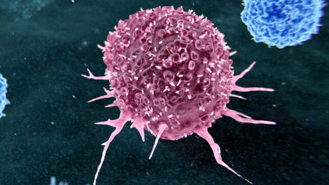 Most Preventable Cancers Are Linked to Just Two Lifestyle Habits