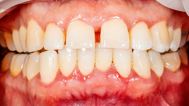 Close-up of human teeth