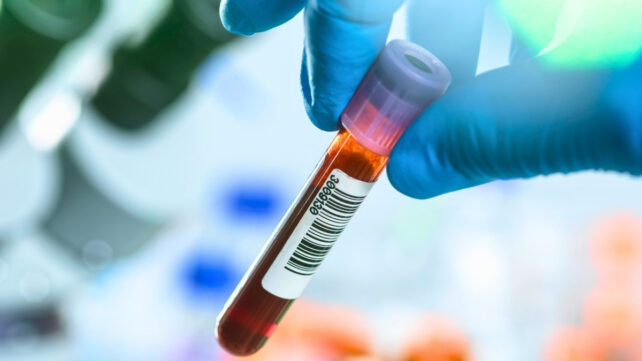 A gloved hand holds a test tube filled with a reddish liquid