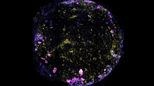 new lung-on-a-chip model