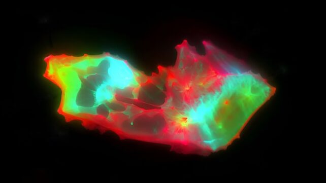 Strange Structures Found Lurking in The Blood of People With Long COVID