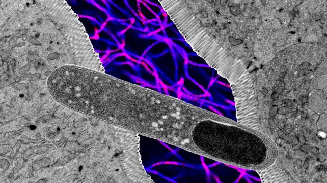 turicbacter-cover