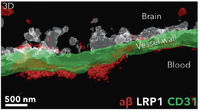Protein clumps are cleared from the vessel wall of the blood-brain barrier. 